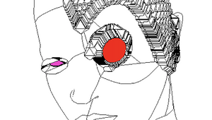 Fractura